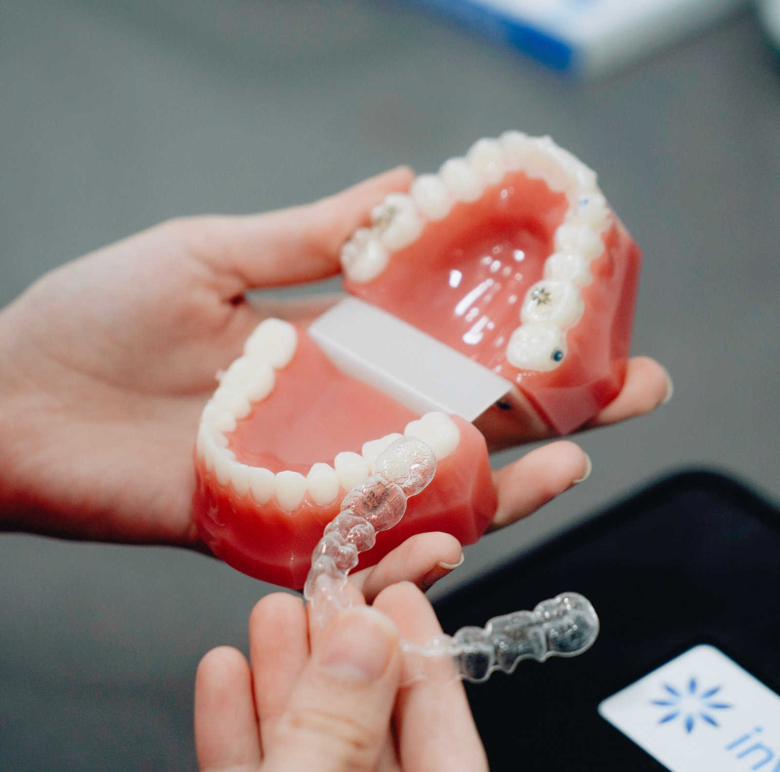 Dental Aligners in Varanasi