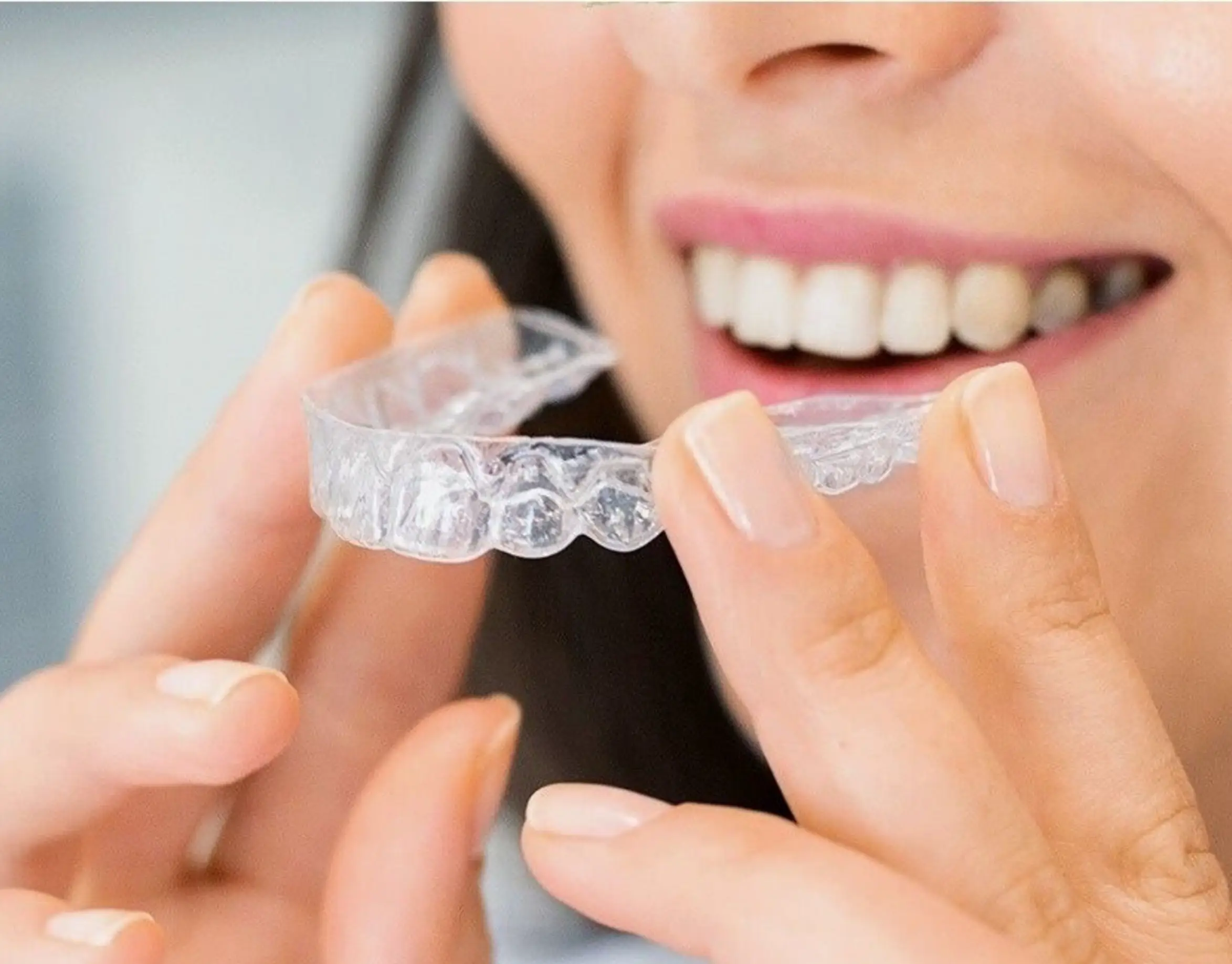 Clear Aligners