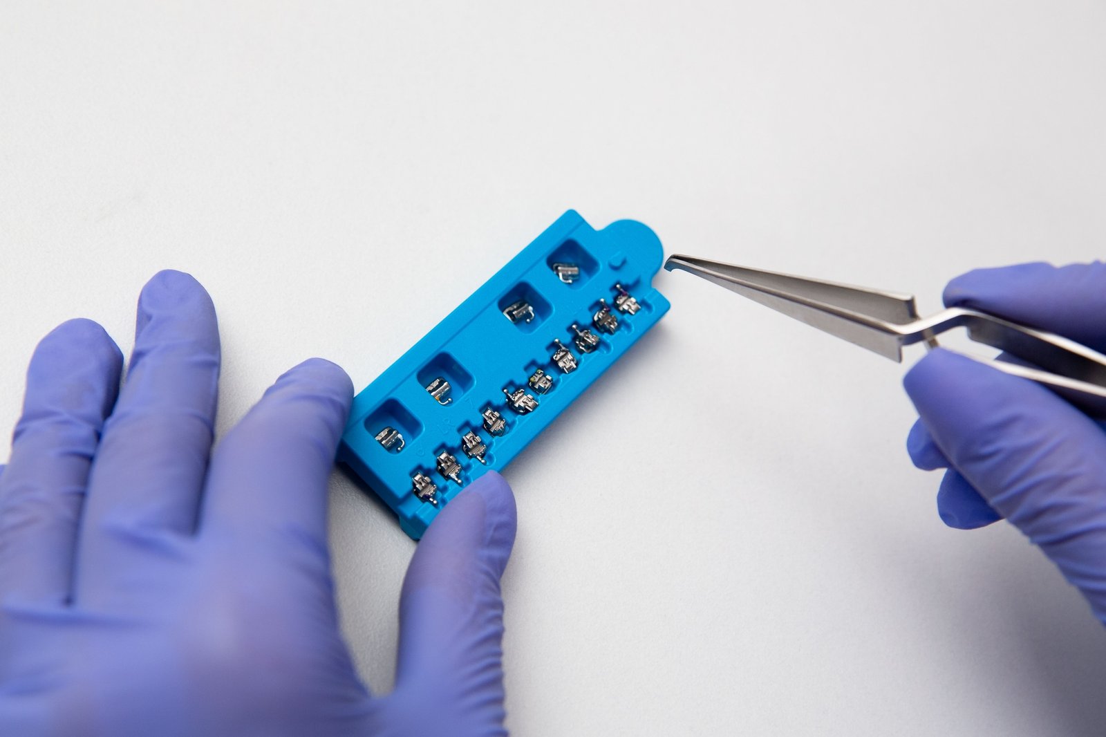 Dental Braces in Varanasi