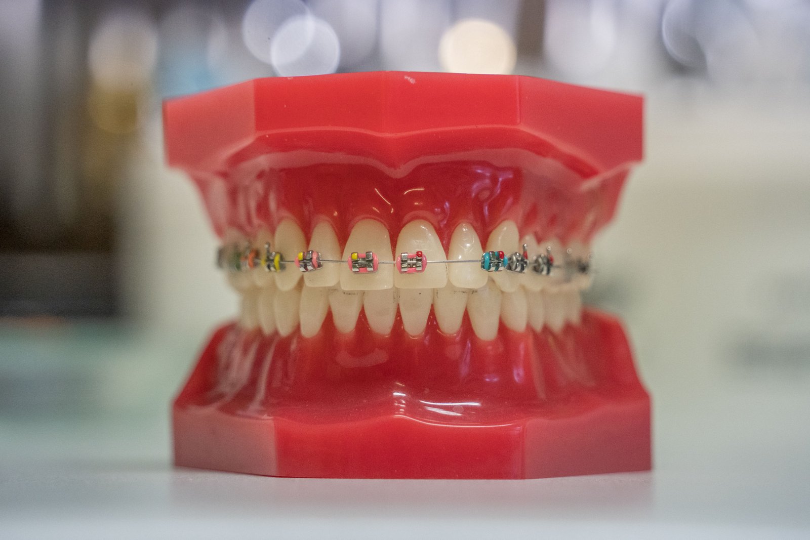 Close up of a removable orthodontic acrylic plate with wires