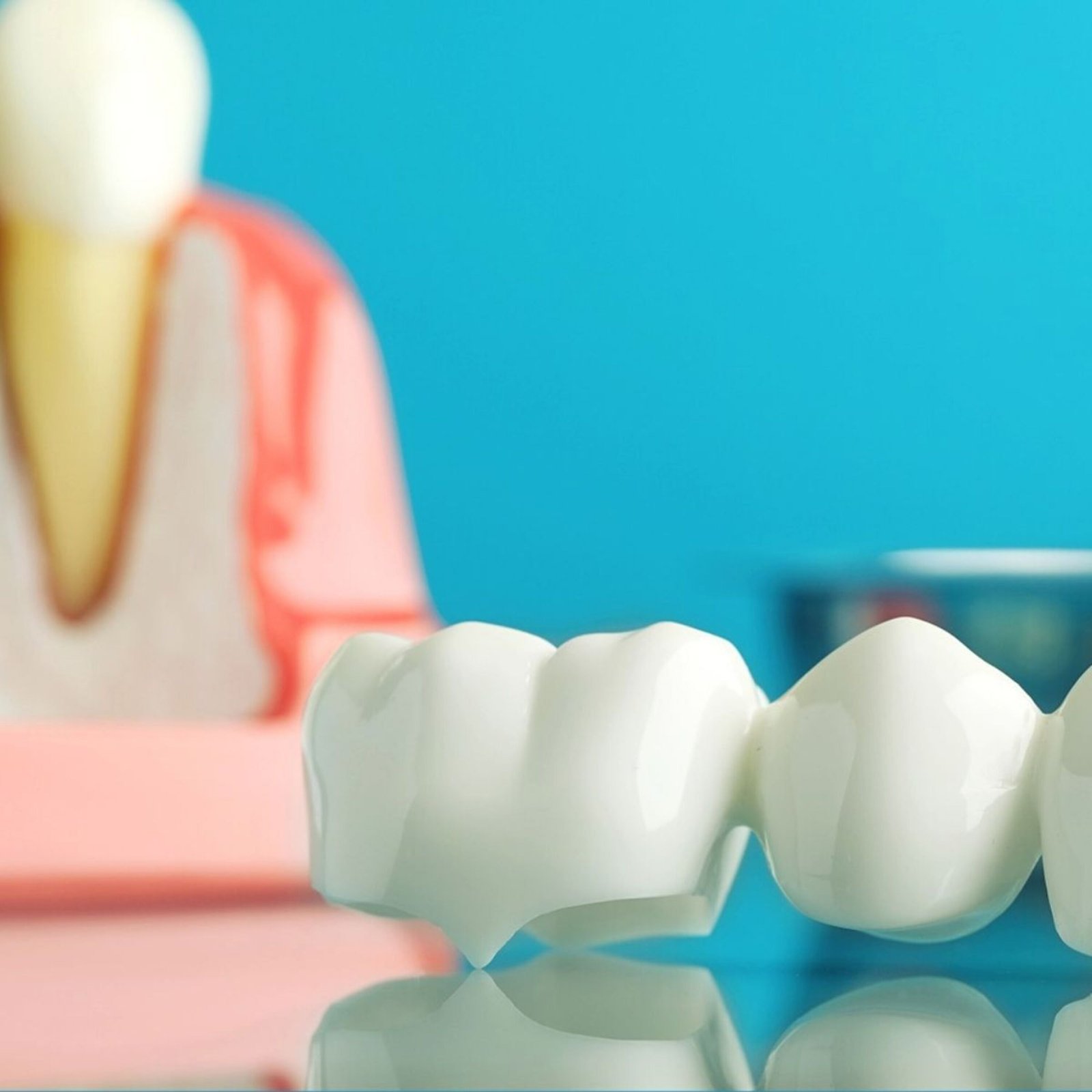 Dental crowns and bridges in Varanasi