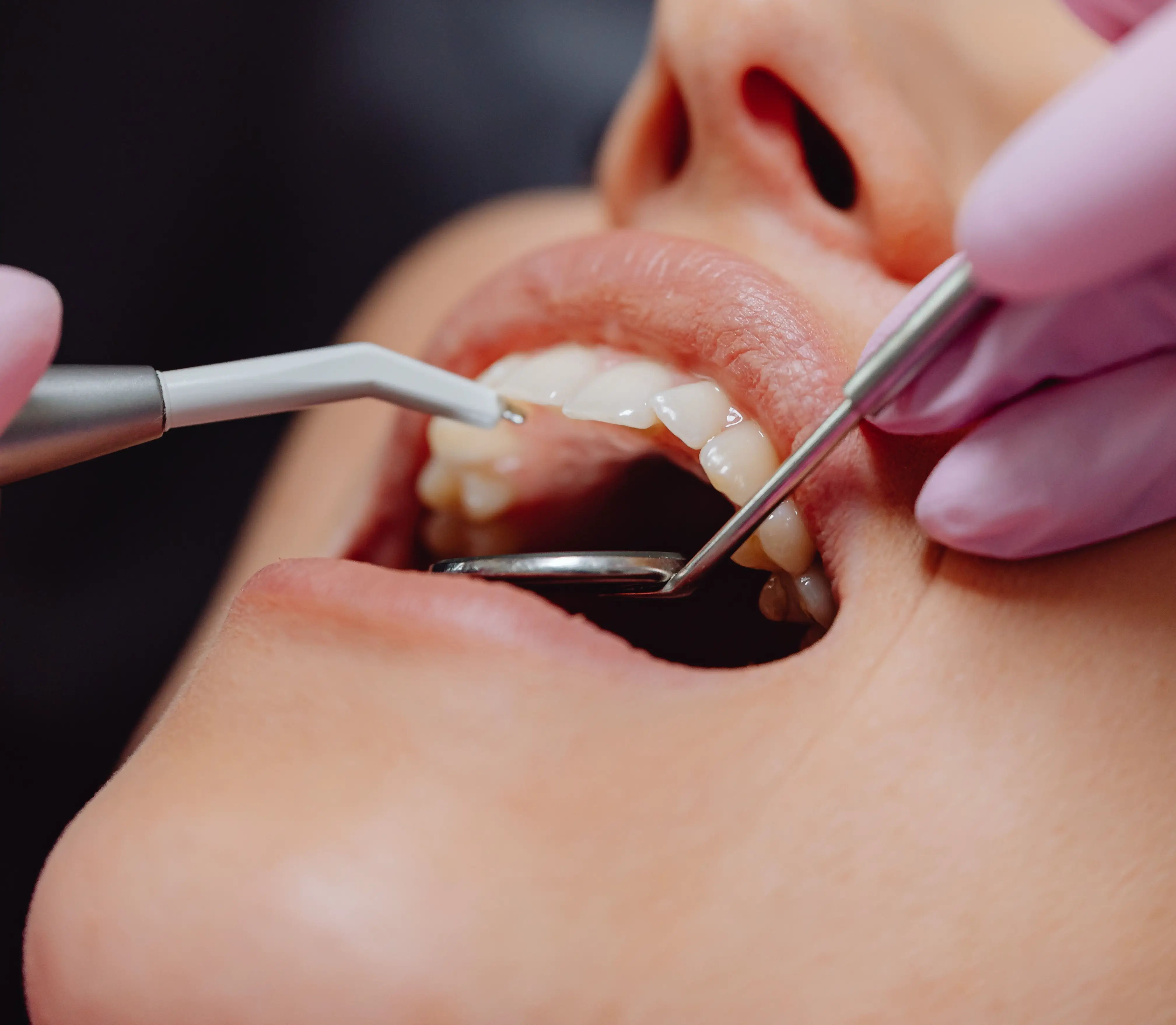 Full Mouth Rehabilitation
