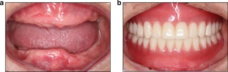 Dentures in Varanasi