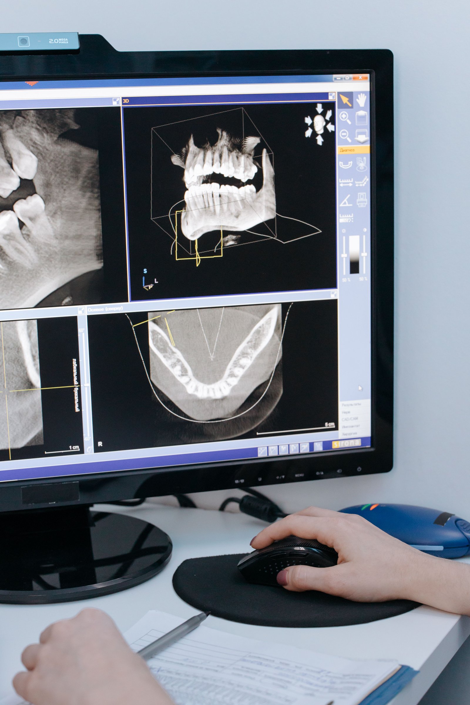 High contrast digital dental radiograph showing tooth roots