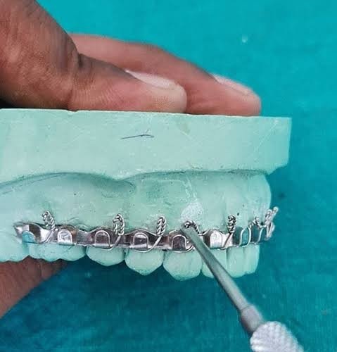 Dental IMF in Varanasi