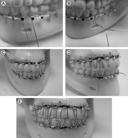 Dental in Varanasi