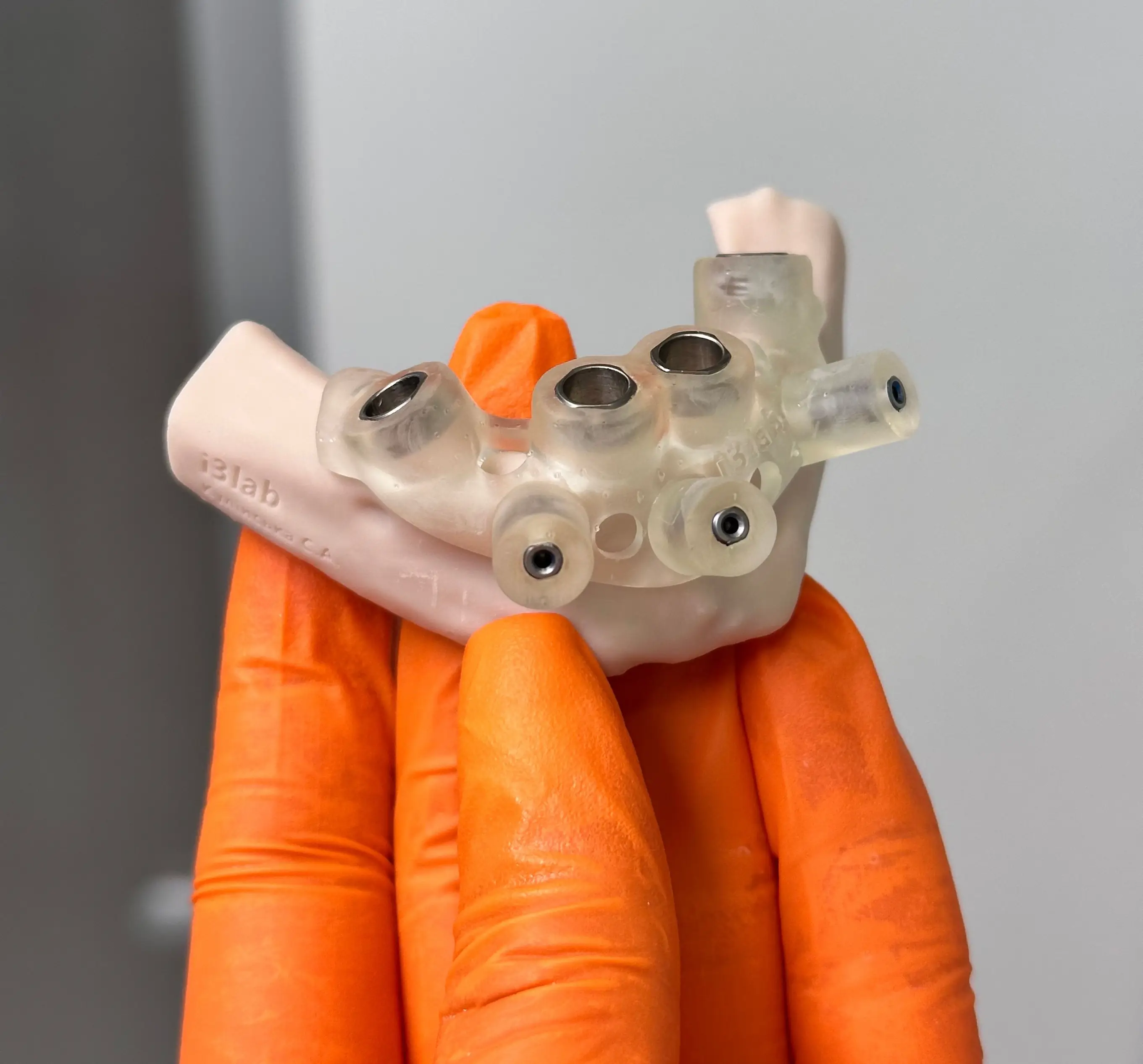 Dental Implants