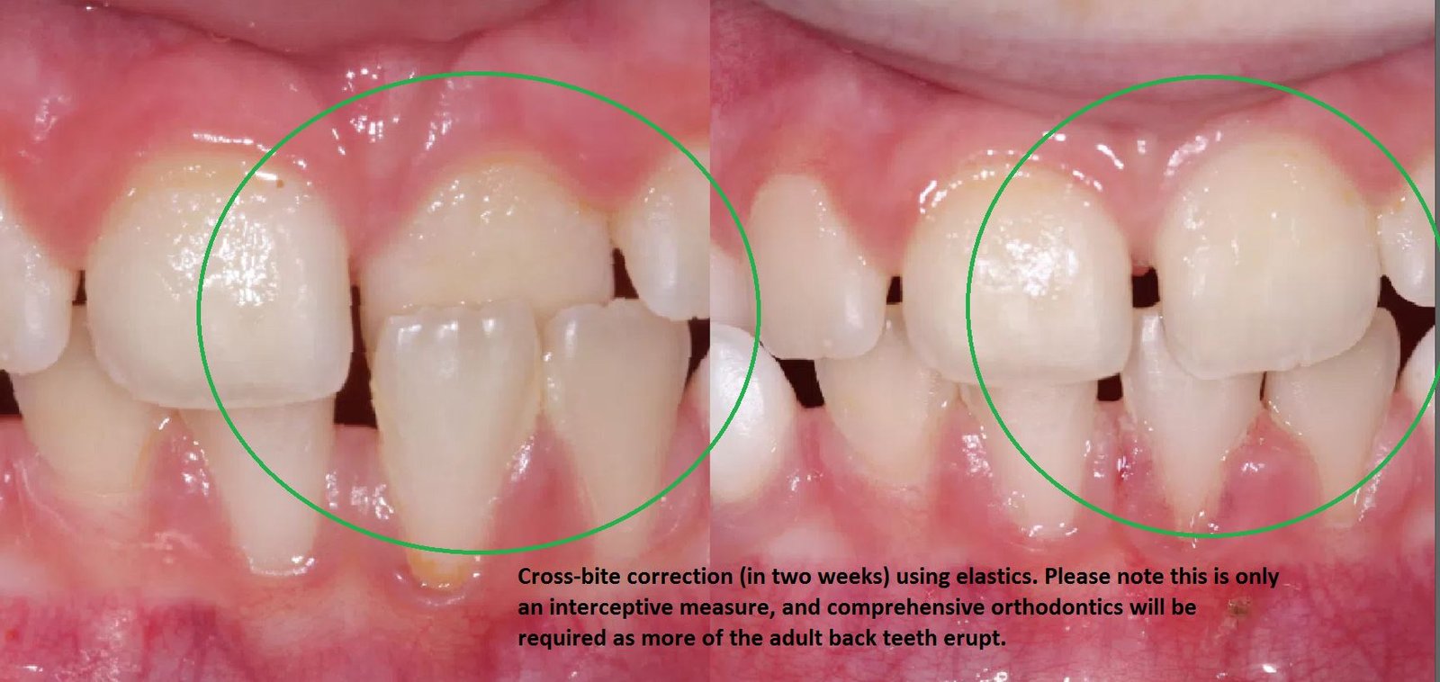 Dental Care in Varanasi