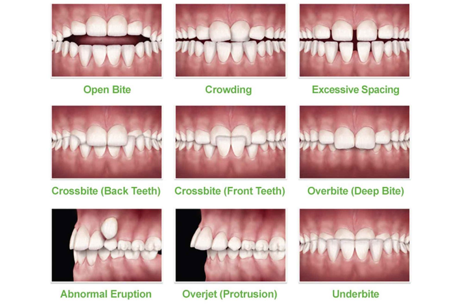 Orthodontics in Varanasi