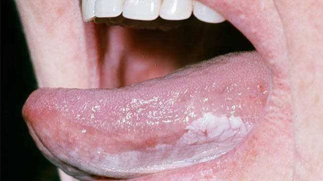 Clinical imagery of oral cavity examination