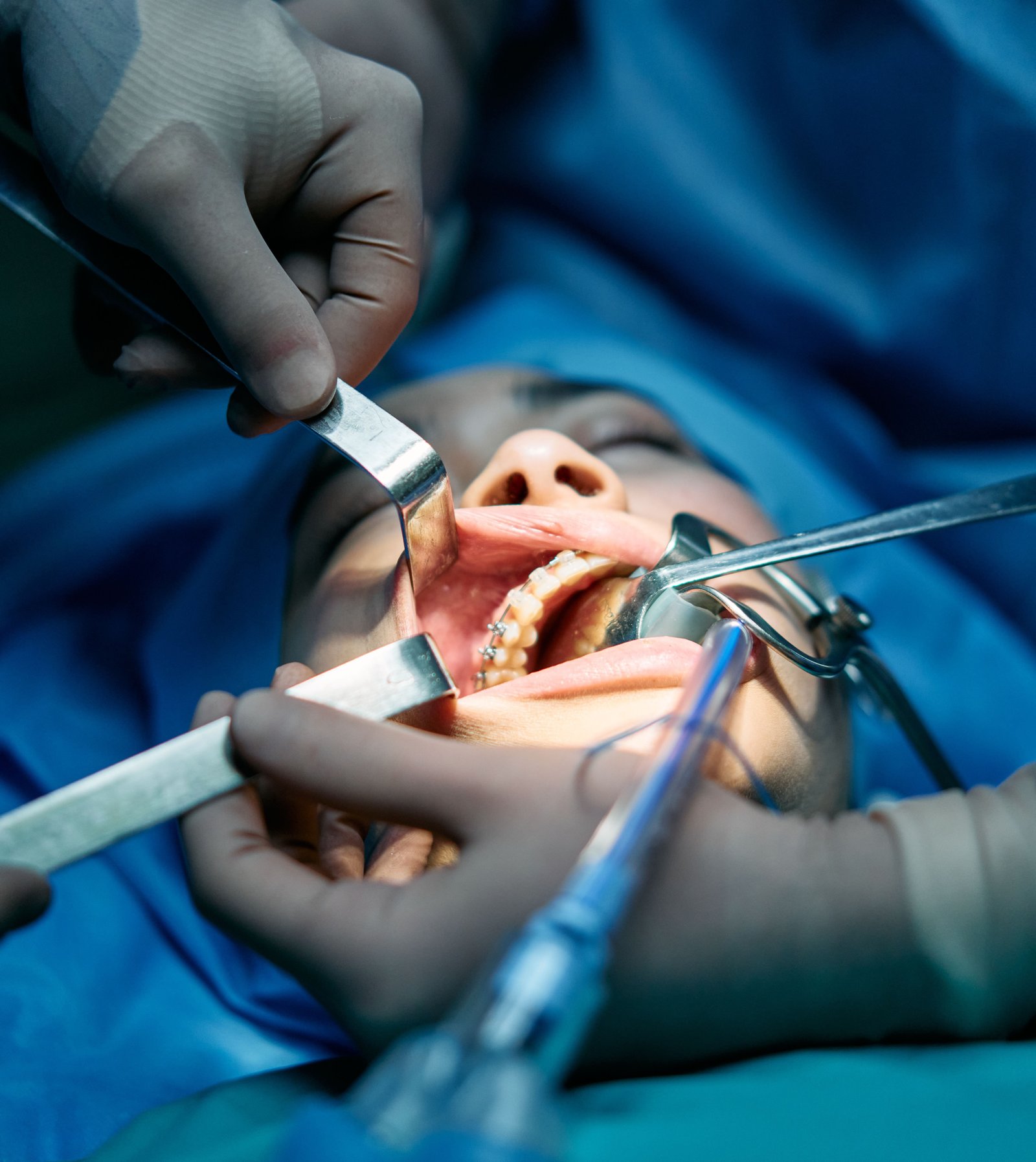 Maxillofacial Expert in Varanasi