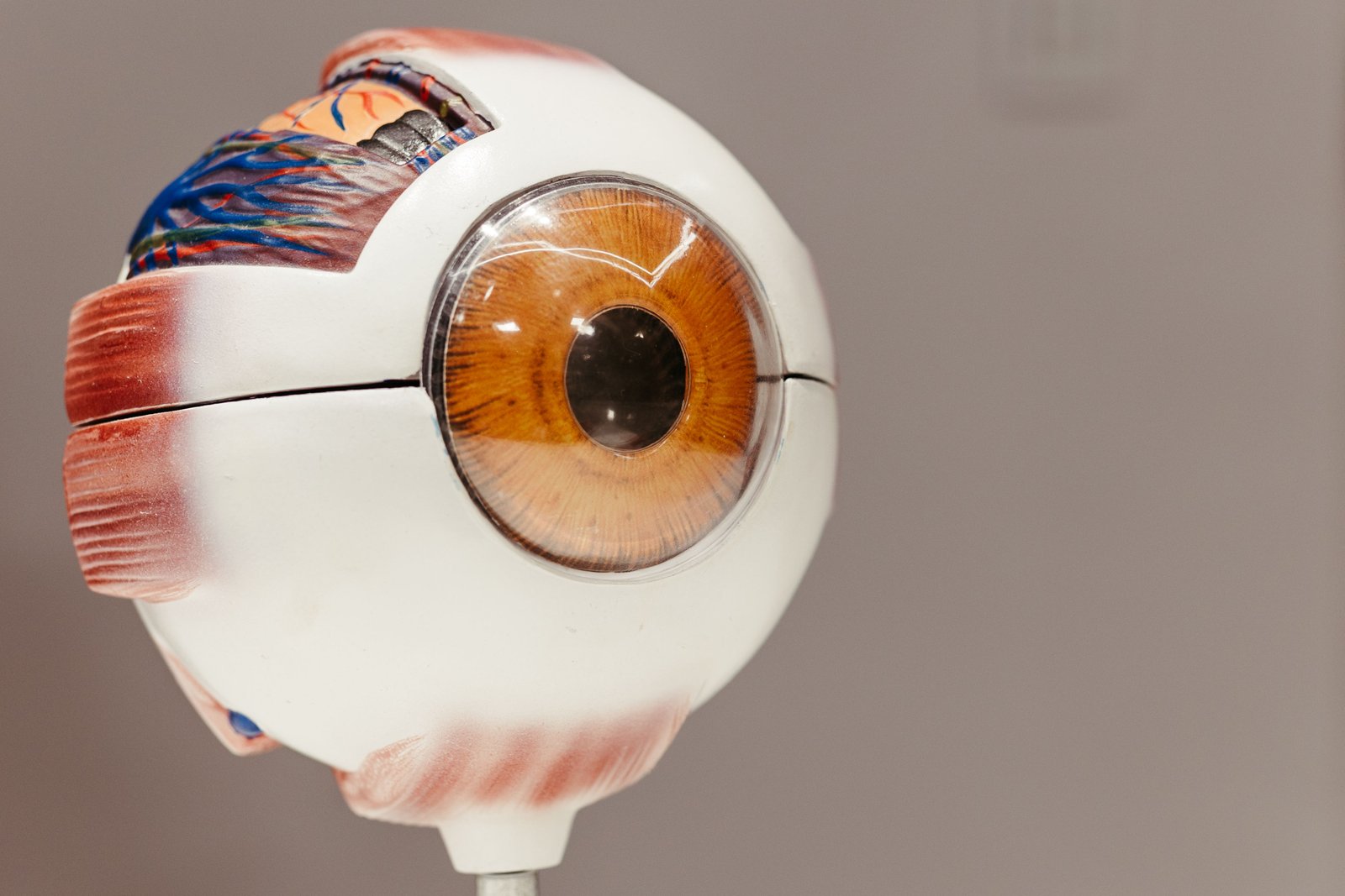 Clinical imagery of a custom acrylic ocular prosthesis