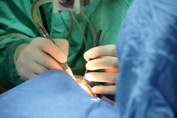 Ocular Prosthesis in Varanasi
