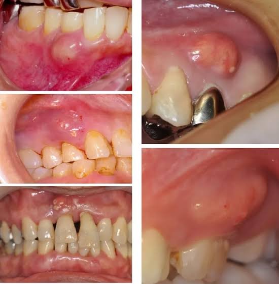 Advanced Endodontics
