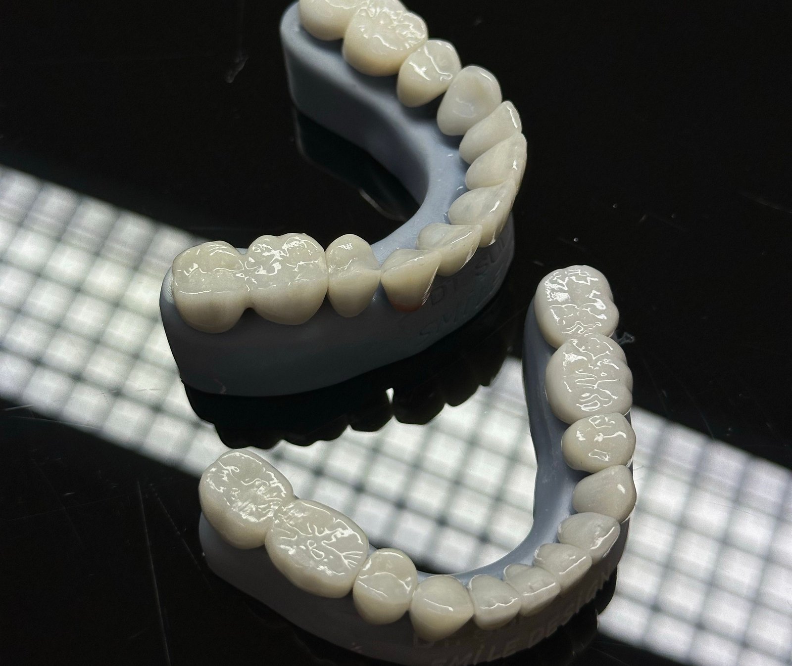 Clinical imagery of a fixed dental prosthesis