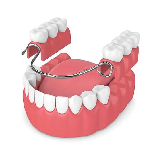 Dental Implants in Varanasi