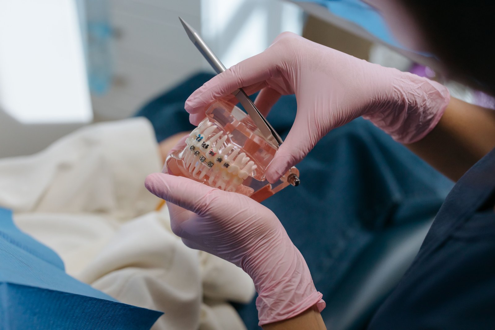 Removable Braces in Varanasi