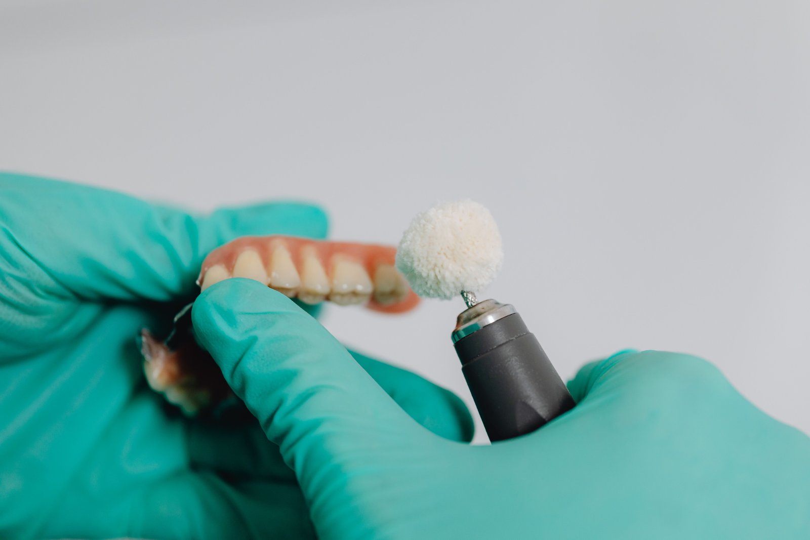 Clinical imagery of a removable dental prosthesis