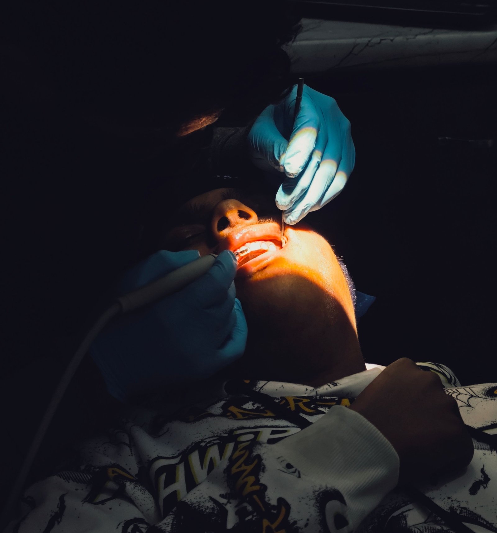 Dental scaling in Varanasi