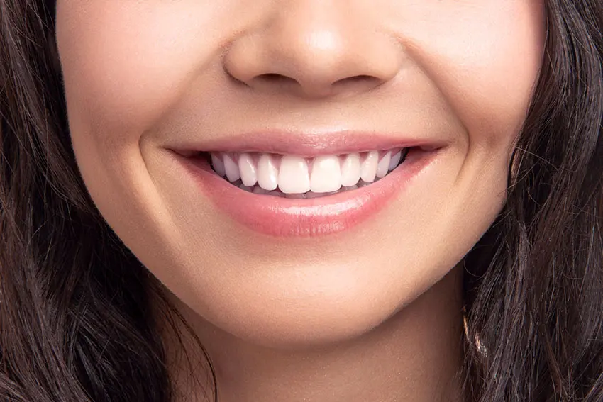 Smile Designing
