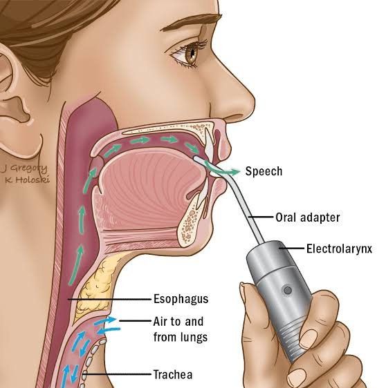Patient undergoing speech therapy