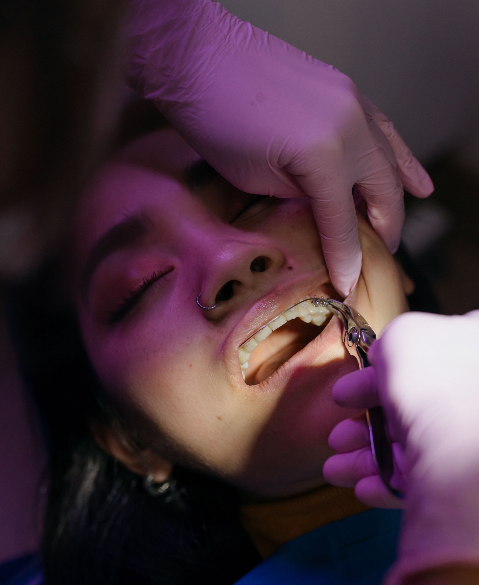 Clinical imagery of oral surgery and tooth extraction
