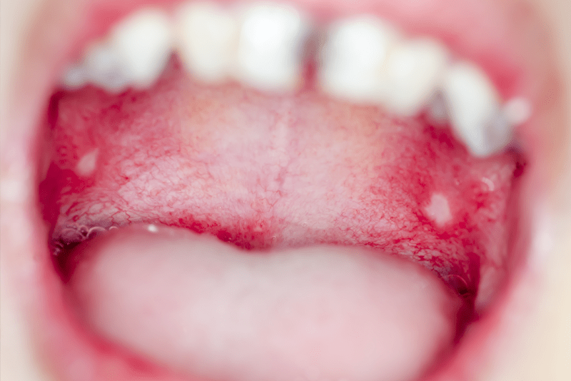 Diagnostic Biopsy Protocol