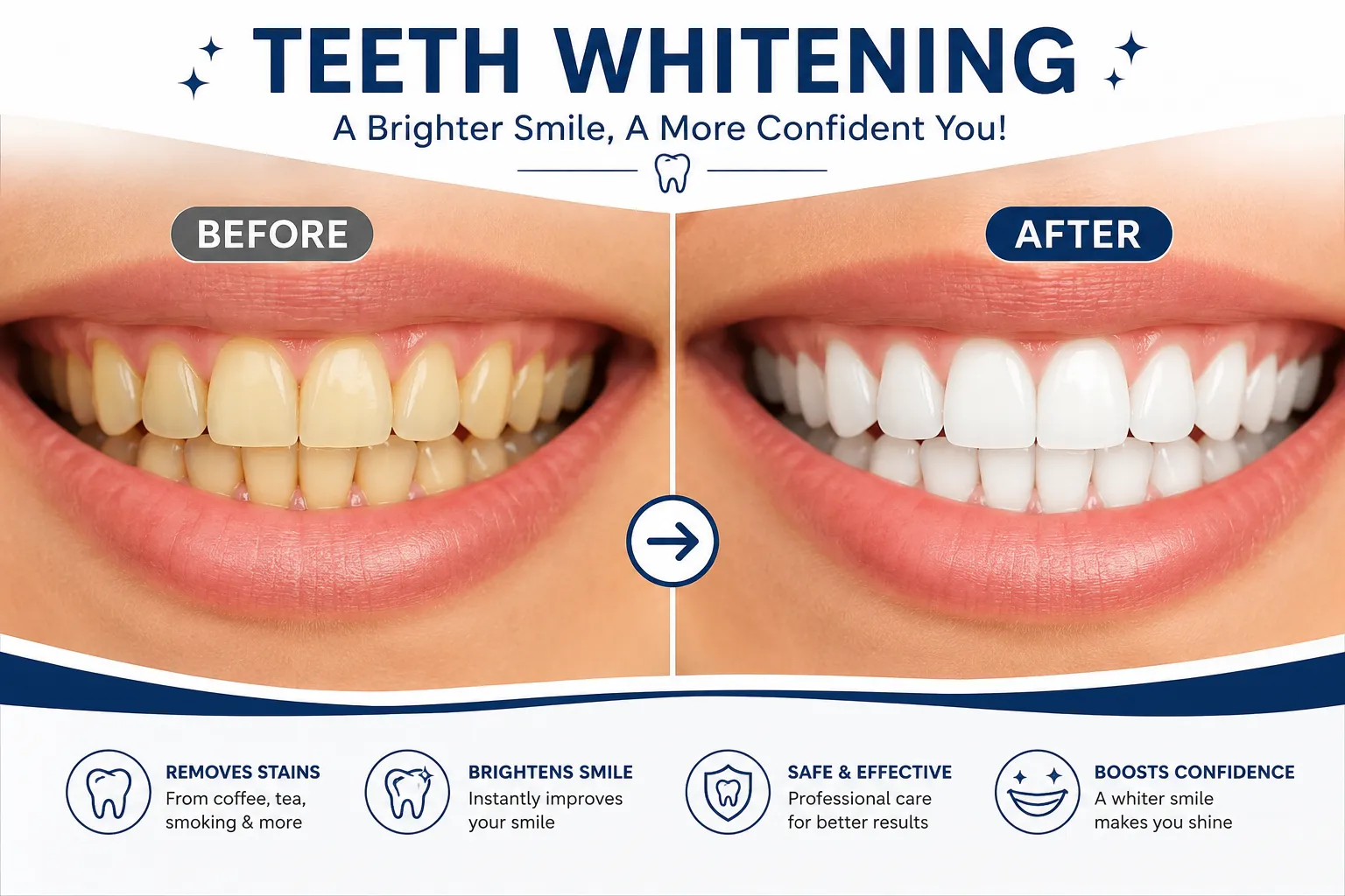 teeth-whitening-in-varanasi