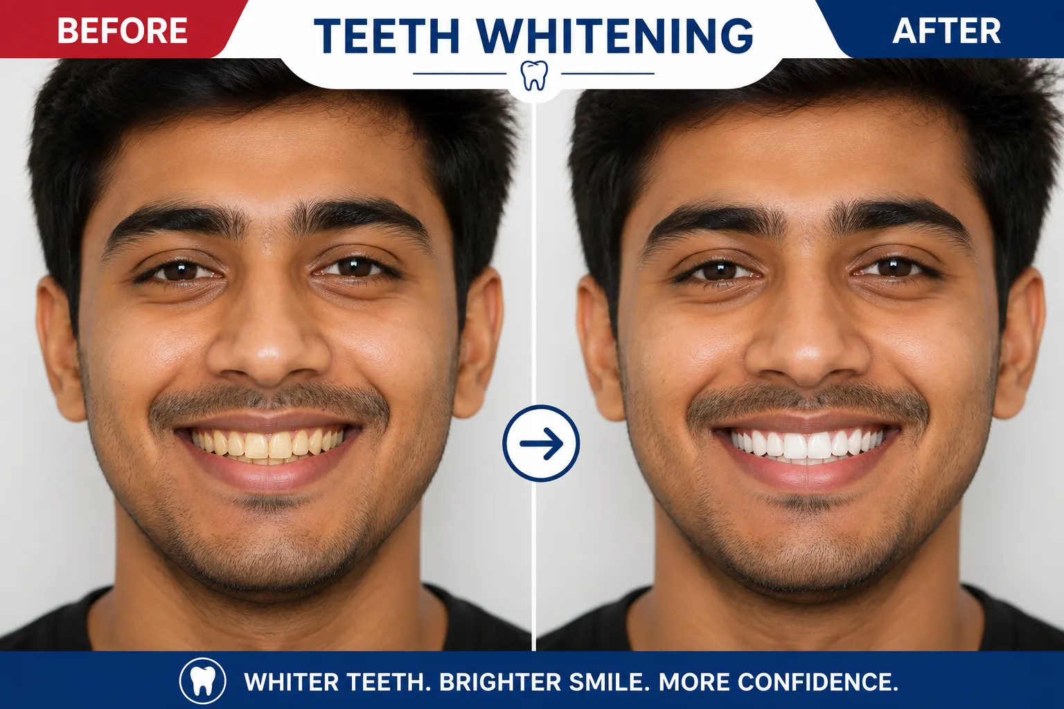 teeth-whitening-in-varanasi