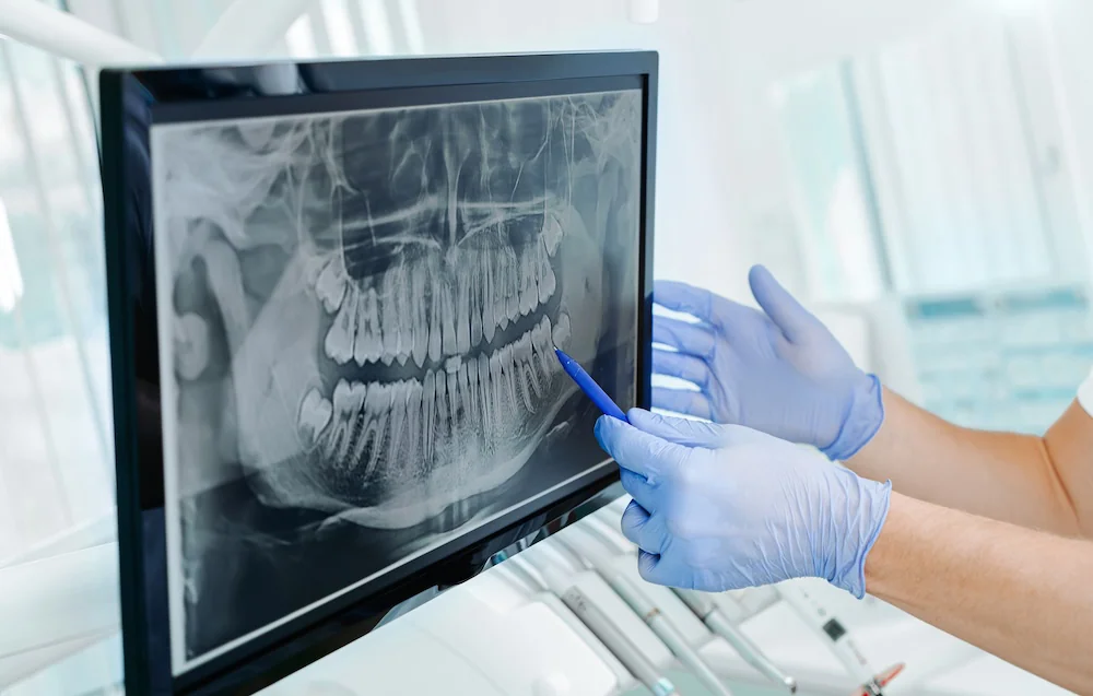 Digital Dental X-Ray Interface